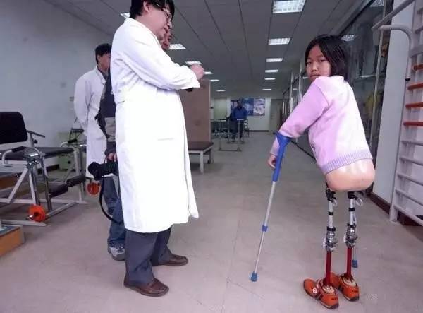 膝关节假肢公司黄页(图1)