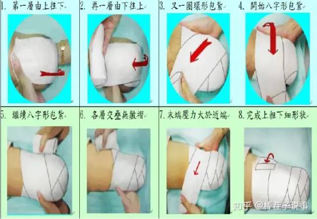 河南假肢下肢安装注意事项(图1)