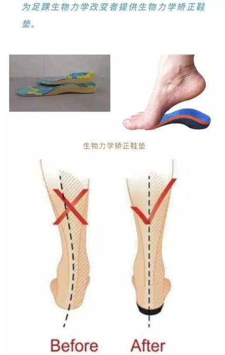 改写叙事：青少年肢体差异、社区可及性与截肢者足球的力量视角(图1)
