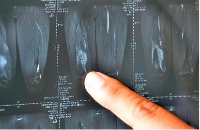 2012年河北女孩7年花200万抗癌亲友劝放弃怒道：我凭啥该死(图15)