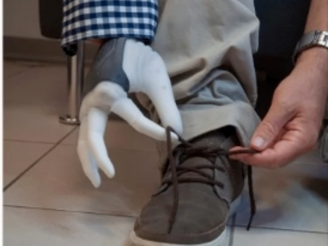 嘉兴宝泰欧假肢康复 宁波康信假肢矫形供应 宁波康信矫形供应-搜了网