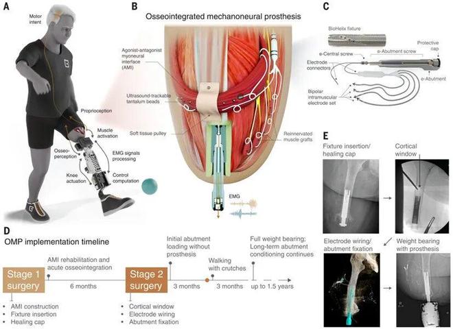 Science正刊：麻省理工学院Hugh Herr 教授成为仿生时代领导者！(图4)